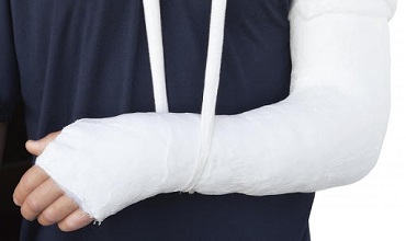 Treatment for Fractures